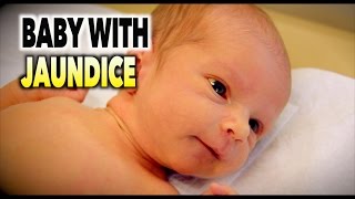 BABY WITH JAUNDICE (Hyperbilirubinemia) | Dr. Paul