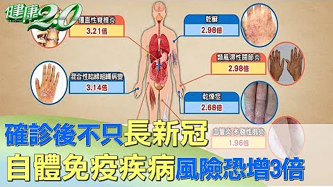 確診後不只長新冠！ 自體免疫疾病風險恐增3倍 健康2.0 - 天天要聞