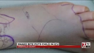 Greenwood girl bitten by venomous snake Copperhead Snake Bites 7 Year Old
