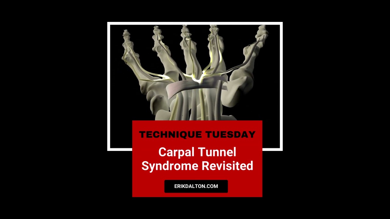 Best Way to Fix Carpal Tunnel Syndrome | ErikDalton.com