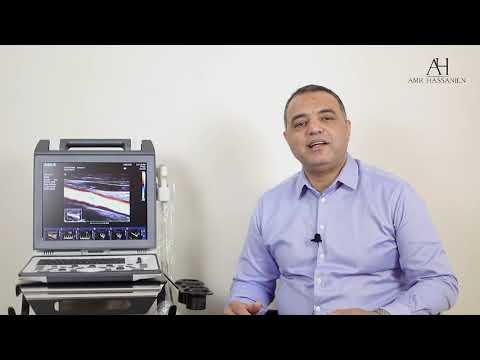 SIUI Apogee 2100 Portable Ultrasound Review