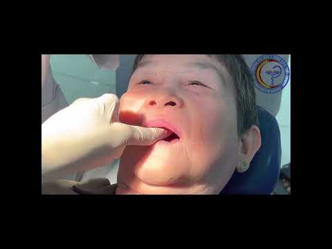 Lấy dấu chức