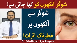 Diabetics Retinopathy Treatment In Urdu/Hindi | Diabetes Related Eye Problem
