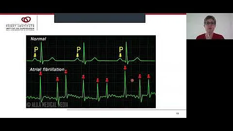 Virtual Class: Lets Talk About Atrial Fibrillation...