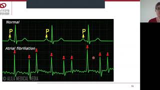 Virtual Class: Let’s Talk About Atrial Fibrillation with Shelley Matthews-Smith