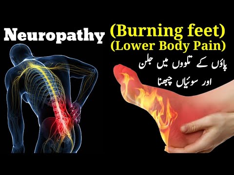 Peripheral Neuropathic Pain Burning Feet And Neuropathic Pain Causes And Symptoms In Urdu Hindi