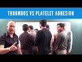 Thrombus vs Platelet Adhesion vs Platelet Aggregation vs Platelet Plug