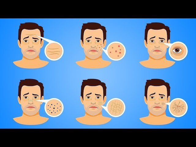 5 Foods That Are BAD for Your SKIN!!!