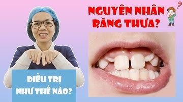 Trẻ thưa răng | Nguyên nhân và cách điều trị hiệu quả