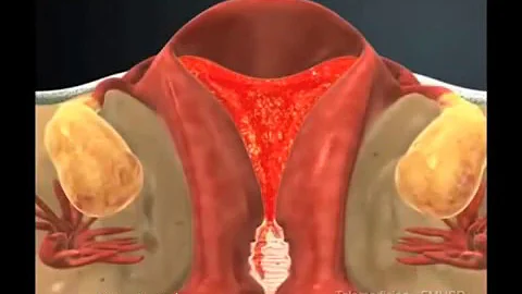 ¿Qué es la barriga menstrual?