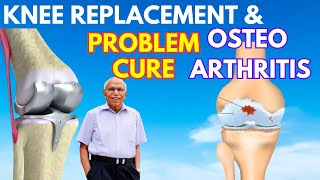 Do THIS If You Have Osteo Arthritis Or Knee Problem - Dr. B M Hegde