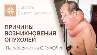 Психосоматика ОПУХОЛИ. Причины возникновения опухолей ► Почему появляются опухоли