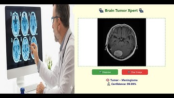 AI Powered Brain Tumor Detection App | MRI Scan Analysis with Deep Learning  | Digi Lectures