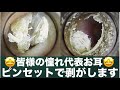 167 #耳掃除 #耳かき #イヤーエステ #earwax 【毎回ピンセット施術希望お客様の耳掃除動画】