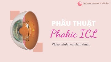 Phẫu thuật Phakic ICL và Phakic IPCL - Video minh họa phẫu thuật | Bệnh viện mắt quốc tế Nhật Bản