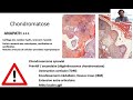 Pathologie de la membrane synoviale du genou