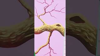 3d tree wallpainting design ideas for beginners. #trending #viral #art #painting #3d #tree #design