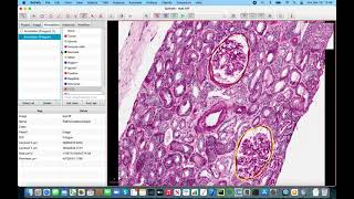Biomedical labeling using QuPath with JSON output