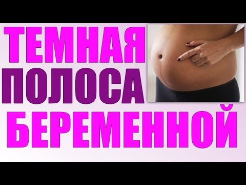 ТЕМНАЯ ПОЛОСА НА ЖИВОТЕ ВО ВРЕМЯ БЕРЕМЕННОСТИ | Причины пигментации кожи на животе беременной