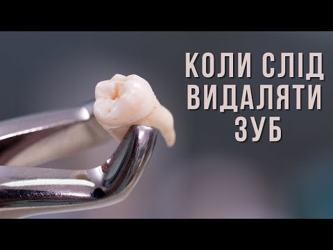Коли потрібно видаляти зуб? | лікар стоматолог Олексій Голіков | Ранок надії | телеканал Надія