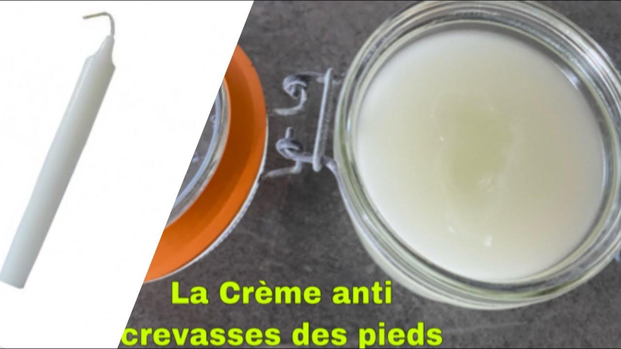 La solution pour traiter les crevasses des pieds