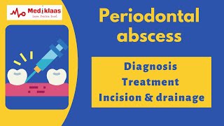 Periodontal abscess (Part 2)  Diagnosis and Treatment l Incision and drainage l Mediklaas