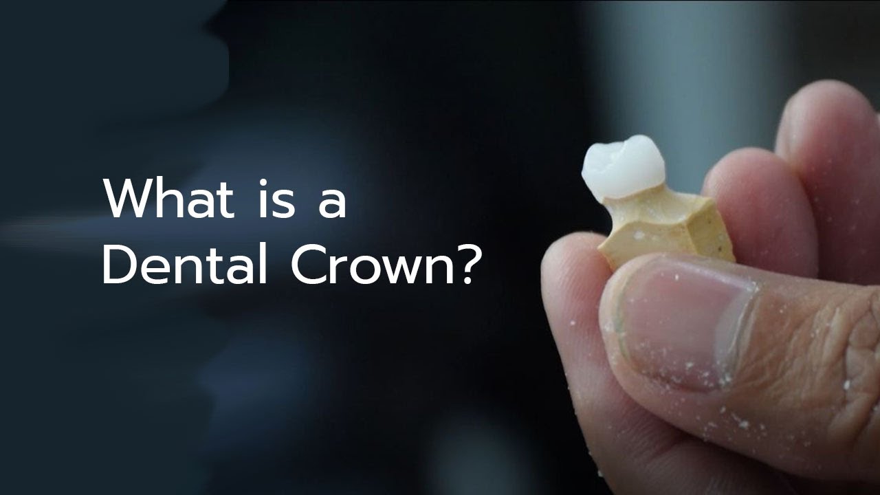 What is Dental Crown? Why Do Dental Crowns? BIDH Dental Hospital
