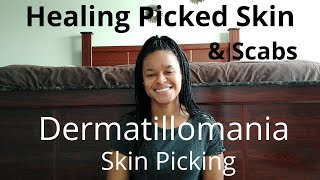 Healing Picked Skin & Scabs | Dermatillomania