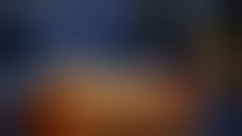 Distal Radius Fracture K wiring and External Fixator | Dr. Prateek Joshi