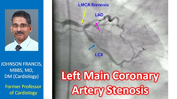 Left main coronary artery stenosis