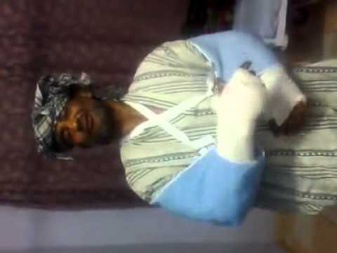 ياسر الاسمر راجع بدون رحمه