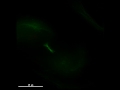 Mitosis in hela tub gfp h2b rfp