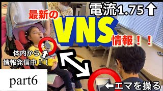 【SCN8A】【VNS】半年ぶりにVNSの電流上げてきた⬆︎⚡️マグネットが効いてたなんて！！