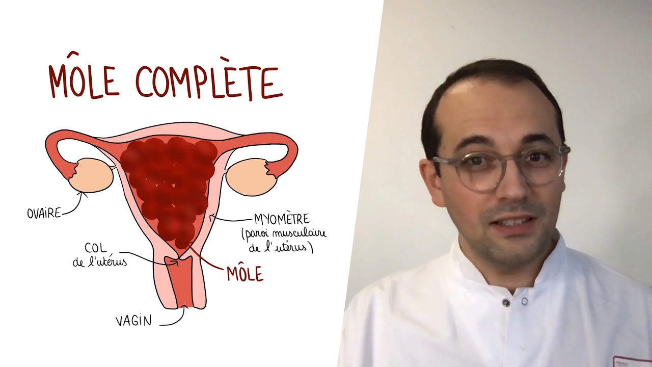 Sensibilisation aux maladies trophoblastiques gestationnelles