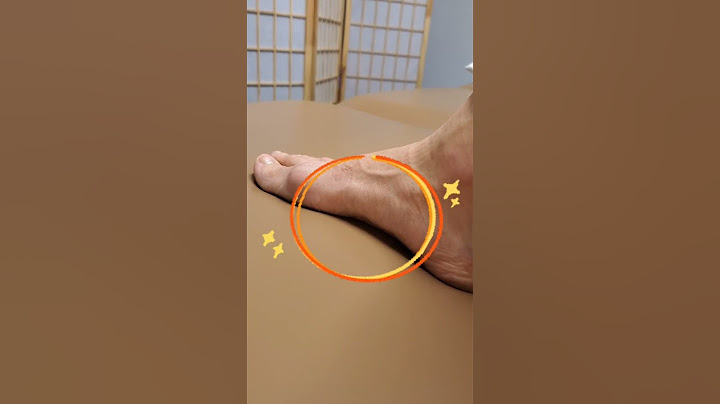 Pain at the arches? This will help your #plantarfasciitis!!
