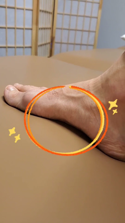 Pain at the arches? This will help your #plantarfasciitis!!