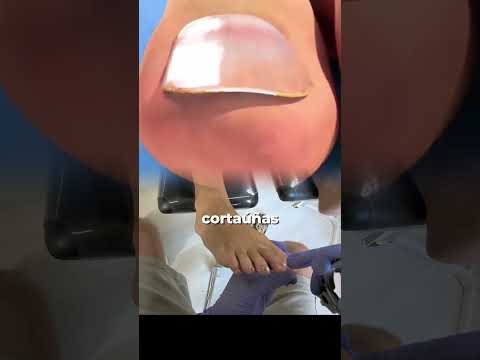 Así debes cortar las uñas de los pies (según un podólogo)