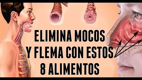 ¿Qué alimentos empeoran las flemas?