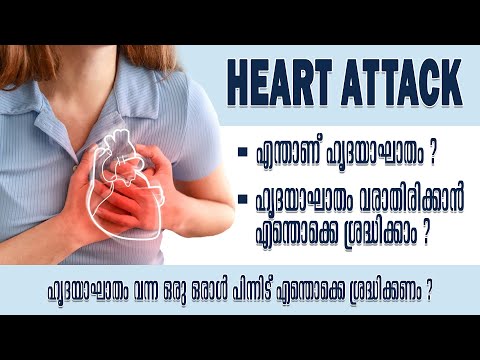 Heart Attack l Health Is Wealth Malayalam #health #healthmalayalam #healthtips #healthylifestyle