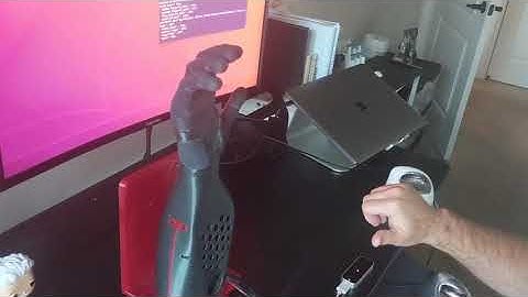 Robotic hand mimics movements of human hand