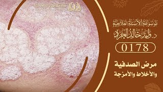السؤال [178] [10-2]: جاءنا شخص يشكو من الصدفية وهو من الأمراض المشتركة في عدة أخلاط ...؟