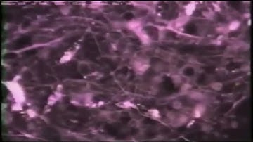 Brain Cells Forming A New Connection - Neuroplasticity