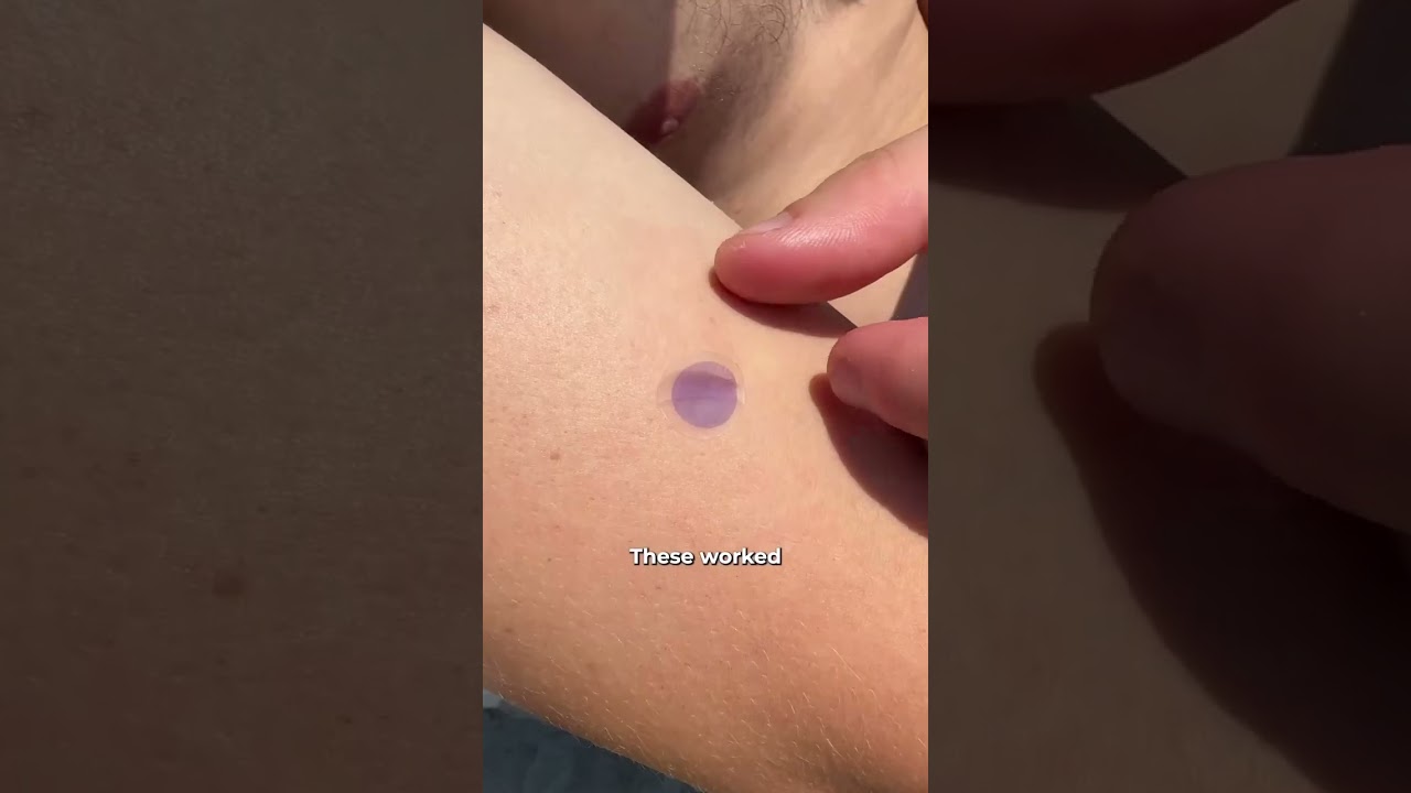Never worry about a sunburn again ☀️