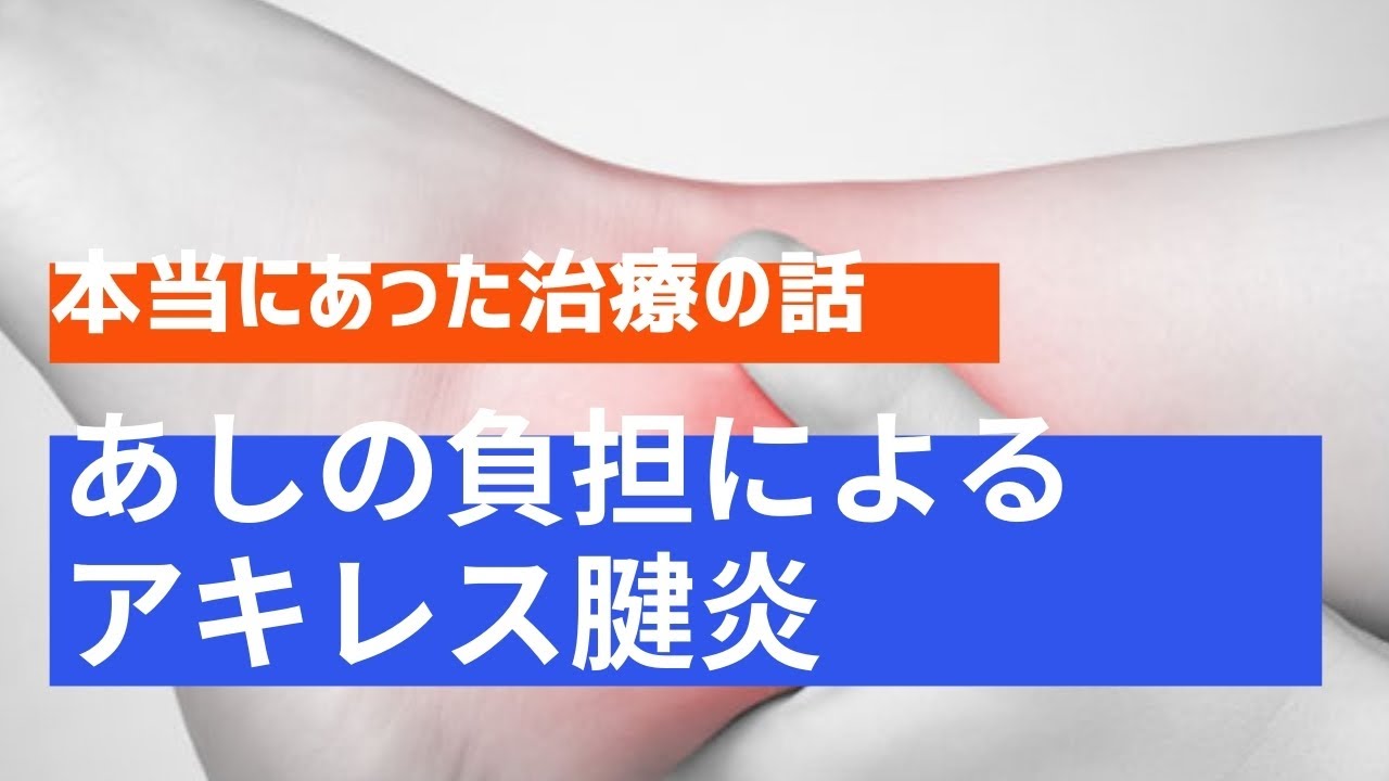 名古屋市の痛み治療専門クリニック 度重なる足の負担により悪化してしまった典型的なアキレス腱炎 なごやevtクリニック