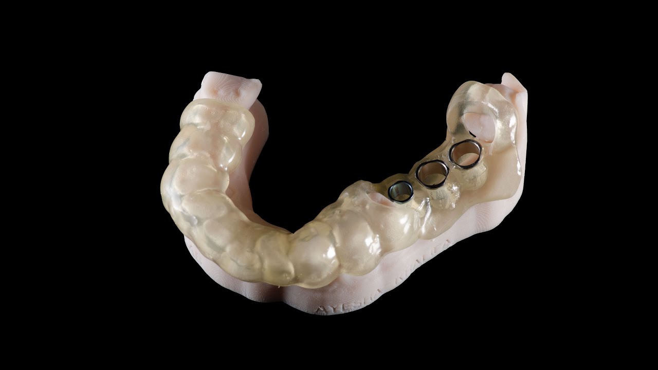 Surgical Guide Case | CAD CAM Dental Lab - YouTube