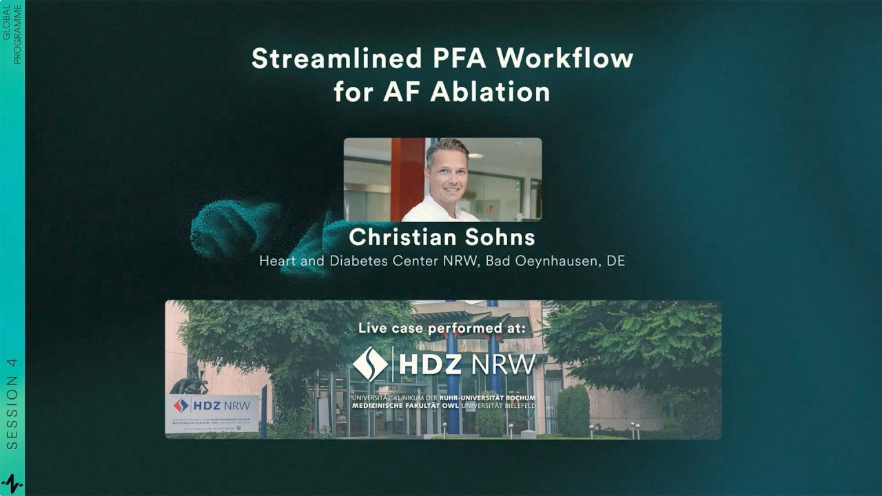 Streamlined PFA Workflow for AF Ablation