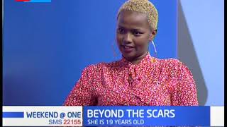Beyond the Scars: Betty Wanjiku talks about how she copes with bipolar
