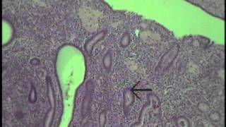 Histology of the Female Reproductive System Part 1