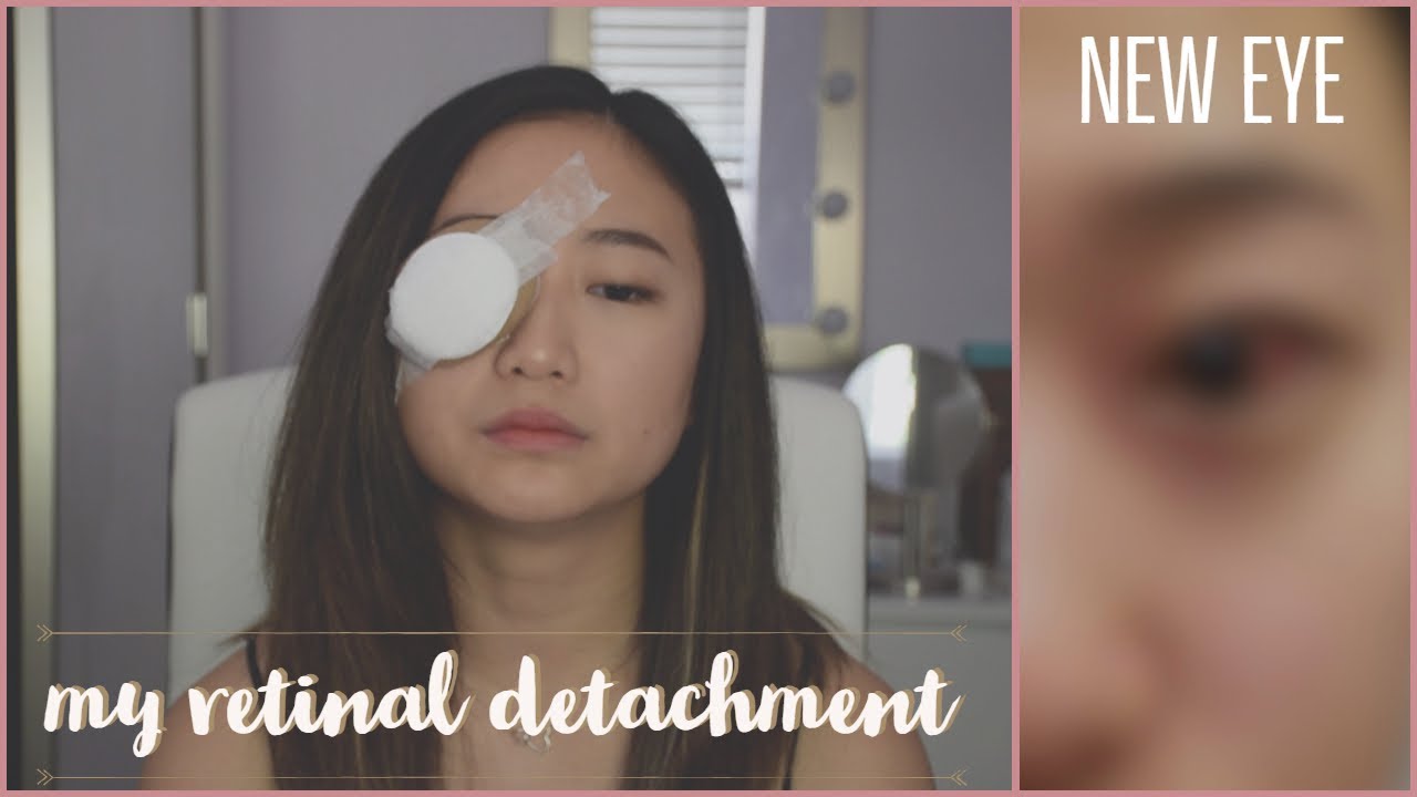 revealing my NEW eye *emotional* | My Retinal Detachment (storytime + vlog + testimony) | Ana Seo
