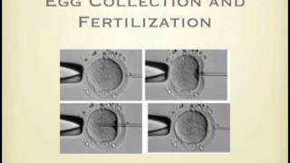IVF -IVM Orientation Part2